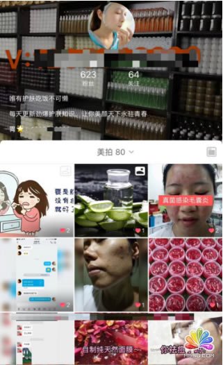 Ĵ삀(g)IP(zhn) (jng)(yn)ĵ 15